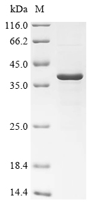 Recombinant Mouse 17-beta-hydroxysteroid dehydrogenase 13 (Hsd17b13)