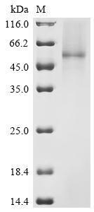 Recombinant Classical swine fever virus Genome polyprotein, partial