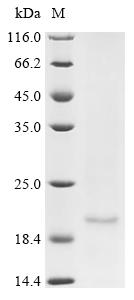 Recombinant Human E3 ubiquitin-protein ligase RNF182 (RNF182), partial