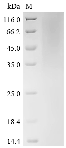 Recombinant Human cytomegalovirus Protein UL16 (UL16), partial