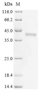 Recombinant Human Guanine nucleotide-binding protein G (i) subunit alpha-3 (GNAI3)