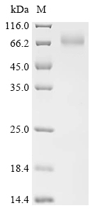 Recombinant Human Carboxylesterase 3 (CES3)