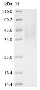 Recombinant Human herpesvirus 6A Immediate-early protein 1 (U90/U89), partial