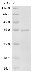 Recombinant Human herpesvirus 1 Triplex capsid protein 2 (TRX2)