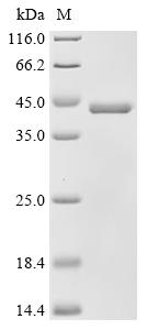 Recombinant Solanum tuberosum Patatin-15
