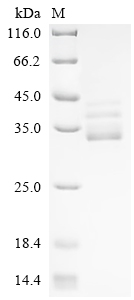 Recombinant Drosophila melanogaster Barrier-to-autointegration factor (baf)