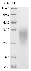 Recombinant Human Platelet glycoprotein Ib beta chain (GP1BB), partial