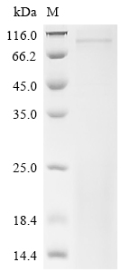 Recombinant Mouse Inactive tyrosine-protein kinase 7 (Ptk7), partial