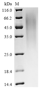 Recombinant Human Metal cation symporter ZIP14 (SLC39A14), partial