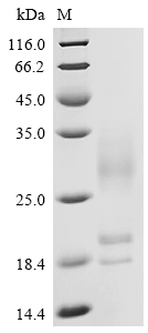 Recombinant Human C-X-C chemokine receptor type 5 (CXCR5), partial
