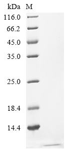 Recombinant Human C-X-C chemokine receptor type 5 (CXCR5), partial