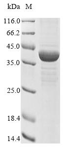 Recombinant Human Acetyl-CoA acetyltransferase, mitochondrial (ACAT1)