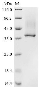 Recombinant Human Tartrate-resistant acid phosphatase type 5 (ACP5)