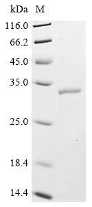 Recombinant Human CCR4-NOT transcription complex subunit 7 (CNOT7)