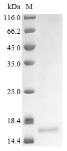 Recombinant Human Lymphocyte antigen 6K (LY6K)