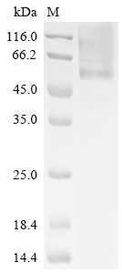 Recombinant Human Glucosylceramidase (GBA)