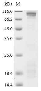 Recombinant Human cGMP-specific 3',5'-cyclic phosphodiesterase (PDE5A) , partial