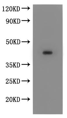 Recombinant Macaca fascicularis Chemokine receptor 8 (CCR8)-VLPs