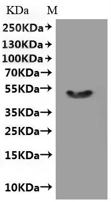 Recombinant Human Transient receptor potential cation channel subfamily M member 8 (TRPM8), partial-VLPs