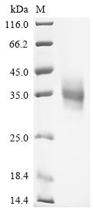 Recombinant Human Folate receptor gamma (FOLR3)