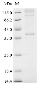 Recombinant Mouse Cannabinoid receptor 2 (Cnr2)