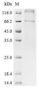 Recombinant Bovine Parathyroid hormone/parathyroid hormone-related peptide receptor (PTH1R)