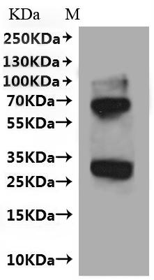 Recombinant Human Very-long-chain enoyl-CoA reductase (TECR)