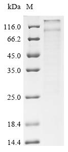 Recombinant Rabbit Potassium voltage-gated channel subfamily KQT member 1 (KCNQ1) (X15W)