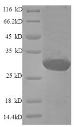 Recombinant Human Endothelin-1 (EDN1), partial