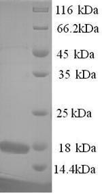 Recombinant Toxoplasma gondii Profilin (PRF)
