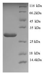 Recombinant Saccharomyces cerevisiae Neutral trehalase (NTH1), partial