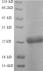 Recombinant Saccharomyces cerevisiae Neutral trehalase (NTH1), partial