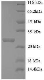 Recombinant Human Telomerase protein component 1 (TEP1), partial