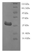 Recombinant Human Telomerase protein component 1 (TEP1), partial