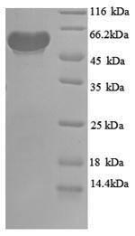 Recombinant Escherichia coli Pyruvate dehydrogenase [ubiquinone] (poxB), partial