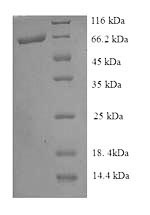 Recombinant Escherichia coli Pyruvate dehydrogenase [ubiquinone] (poxB)
