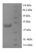 Recombinant Human Zinc transporter ZIP1 (SLC39A1), partial