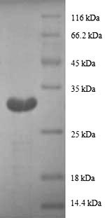 Recombinant Human Metallothionein-1G (MT1G), partial