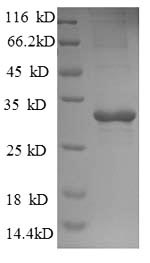 Recombinant Saccharomyces cerevisiae Trehalose-phosphatase (TPS2), partial