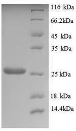Recombinant Saccharomyces cerevisiae Trehalose-phosphatase (TPS2), partial