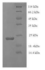 Recombinant Human Caspase-7 (CASP7), partial