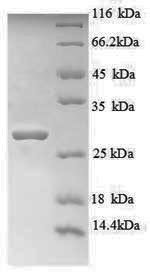 Recombinant Human Titin (TTN), partial