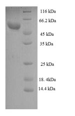 Recombinant Human Zona pellucida sperm-binding protein 3 (ZP3), partial