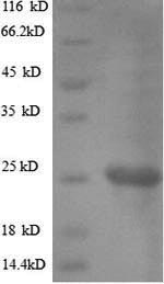 Recombinant Helicobacter pylori Vacuolating cytotoxin autotransporter (vacA), partial