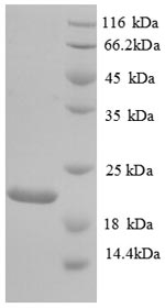 Recombinant Human Urokinase-type plasminogen activator (PLAU), partial