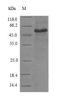 Recombinant Human Vinculin (VCL), partial