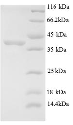 Recombinant Human E3 ubiquitin-protein ligase MIB1 (MIB1), partial