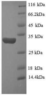 Recombinant Human Hypoxia-inducible factor 1-alpha (HIF1A), partial