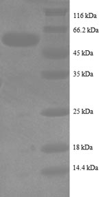 Recombinant Human Intestinal-type alkaline phosphatase (ALPI), partial