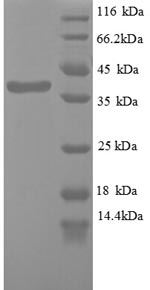 Recombinant Human Wilms tumor protein (WT1), partial